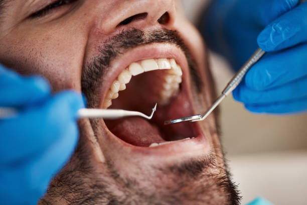 Best Emergency Dental Care for Broken or Chipped Teeth in South Duxbury, MA